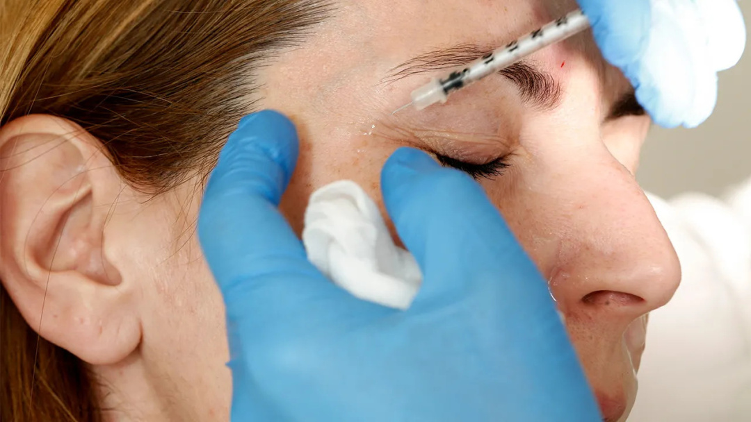 Imposter Doctor Leaves Massachusetts Woman with Permanent Scars from Surgery